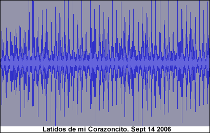 Latido Corazon Sept 14 2000.gif